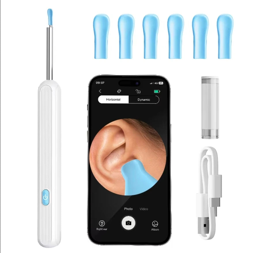 HD Ear Wax Removal Camera Kit – 1296P Otoscope with LED Lights