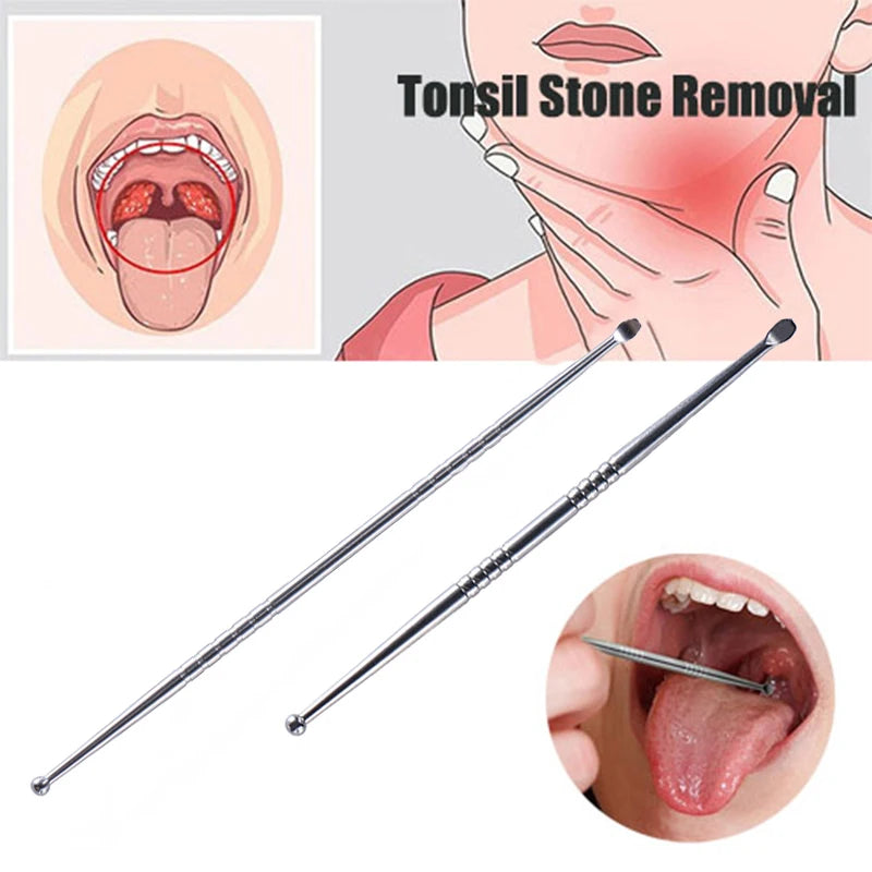 Stainless Steel Tonsil Stone & Ear Wax Remover Tool – Oral Care